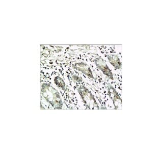 CD20 Antibody