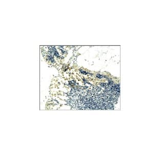 CD3 Antibody