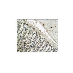 IL-1 beta Antibody