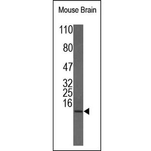 IGF1 Antibody