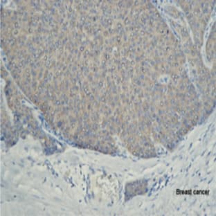 Purified anti-human DcR3 avatar