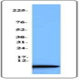 Purified anti-human RANTES (CCL5) avatar