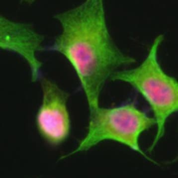 Purified anti-NBS1 avatar