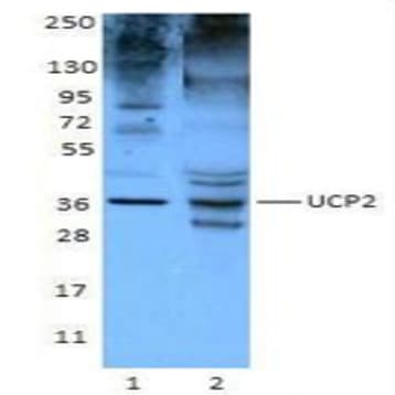 Purified anti-UCP2 avatar