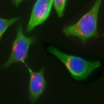 Purified anti-Artemis avatar