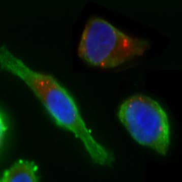 Purified anti-EGFR avatar