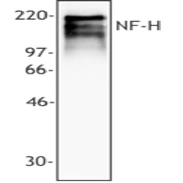 Purified anti-Neurofilament heavy protein (NF-H) avatar
