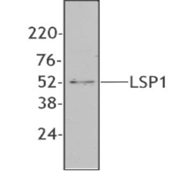 Purified anti-human LSP1 avatar