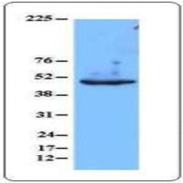 Purified anti-GFAP avatar