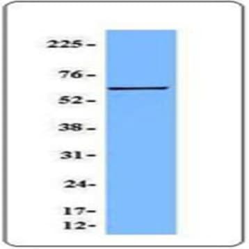 Purified anti-eIF3D (p66) avatar