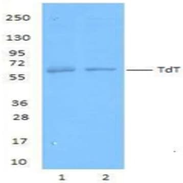 Purified anti-TdT avatar