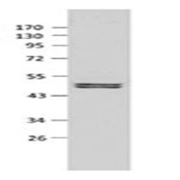 Purified anti-Ataxin-3 avatar