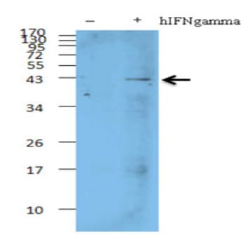 Purified anti-AIM2 avatar
