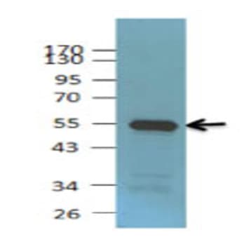 Purified anti-Rad23B