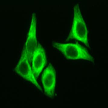 Alexa Fluor(R) 488 anti-NF-kappaB p50 avatar