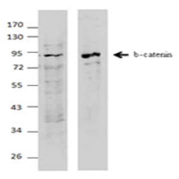 Purified anti-beta-catenin avatar
