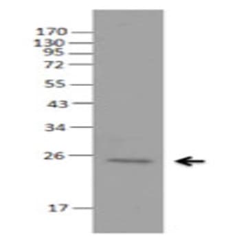 Purified anti-ASC (TMS-1) avatar
