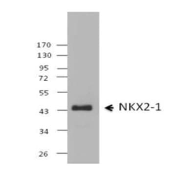 Purified anti-NKX2-1 (TTF-1) avatar
