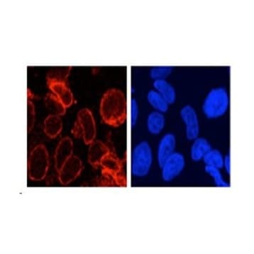 gp210 Antibody avatar