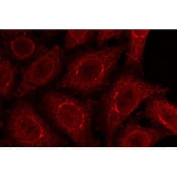 gp210 Antibody avatar