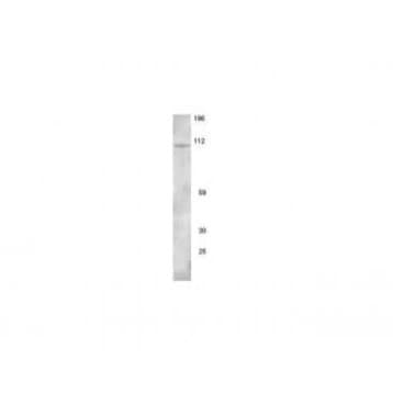 NMDAR1 Antibody avatar