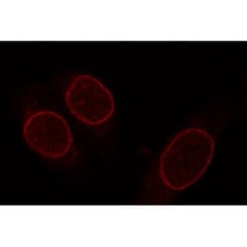 Nup153 Antibody avatar