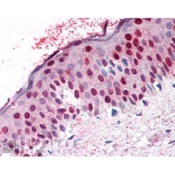 RanGAP1 Antibody avatar