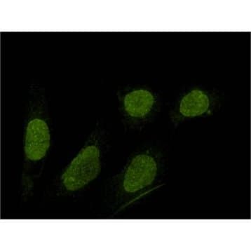 SUN1 Antibody avatar
