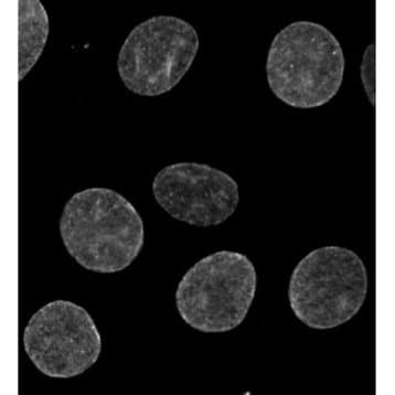 SUN2 Antibody avatar