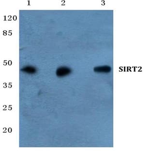 SIRT2 pAb avatar