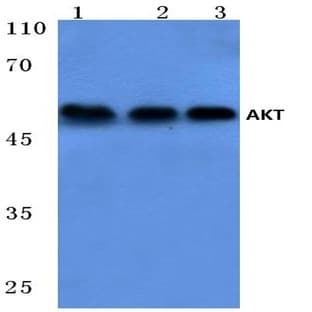 AKT pAb avatar