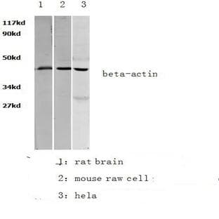 (beta)-Actin pAb avatar