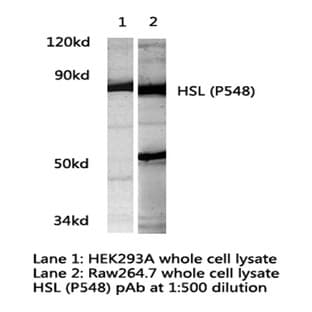 HSL (P548) pAb avatar