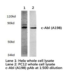 ABL1 (A198) pAb avatar