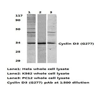 Cyclin D3 (G277) pAb avatar