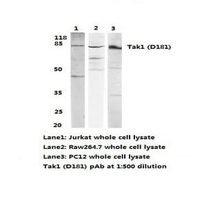 Tak1 (D181) pAb avatar