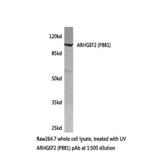 ARHGEF2 (P881) pAb avatar