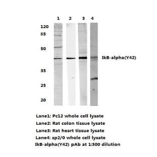 IkB-(alpha) (Y42) pAb avatar