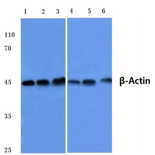 (beta)-Actin (I102) pAb avatar