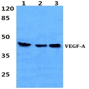 VEGF-A (K27) pAb avatar