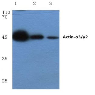 Actin-(alpha)3/(gamma)2 (E2) pAb avatar