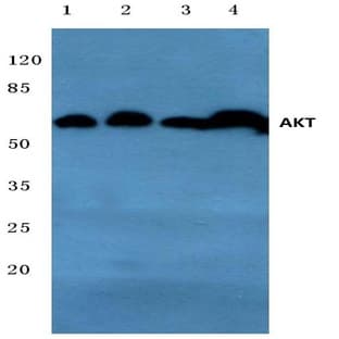AKT (D302) pAb avatar