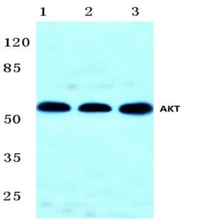 AKT (F469) pAb avatar