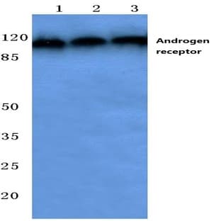 AR (E646) pAb avatar