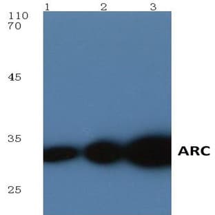 ARC (E194) pAb avatar