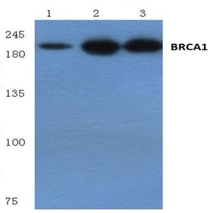 BRCA1 (Q1518) pAb avatar