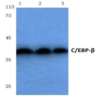 C/EBP-(beta) (S229/182) pAb avatar