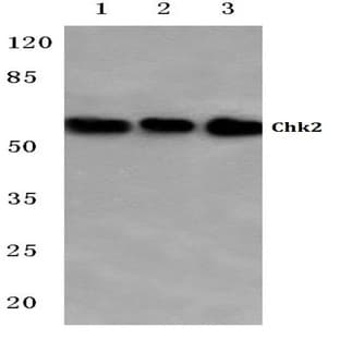 Chk2 (Q510) pAb avatar