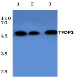 TFDP1 (V393) pAb avatar