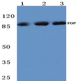 FGFR1 OP (N371) pAb avatar